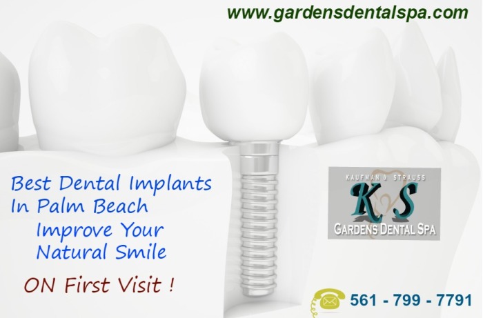 Palm Beach Gardens Experienced Dentist & Quality Dental Implants Services